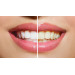 Відбілюючі смужки для зубів Crest 3D Whitestrips Glamorous White Dental Teeth Whitening Strips (1 стікер)